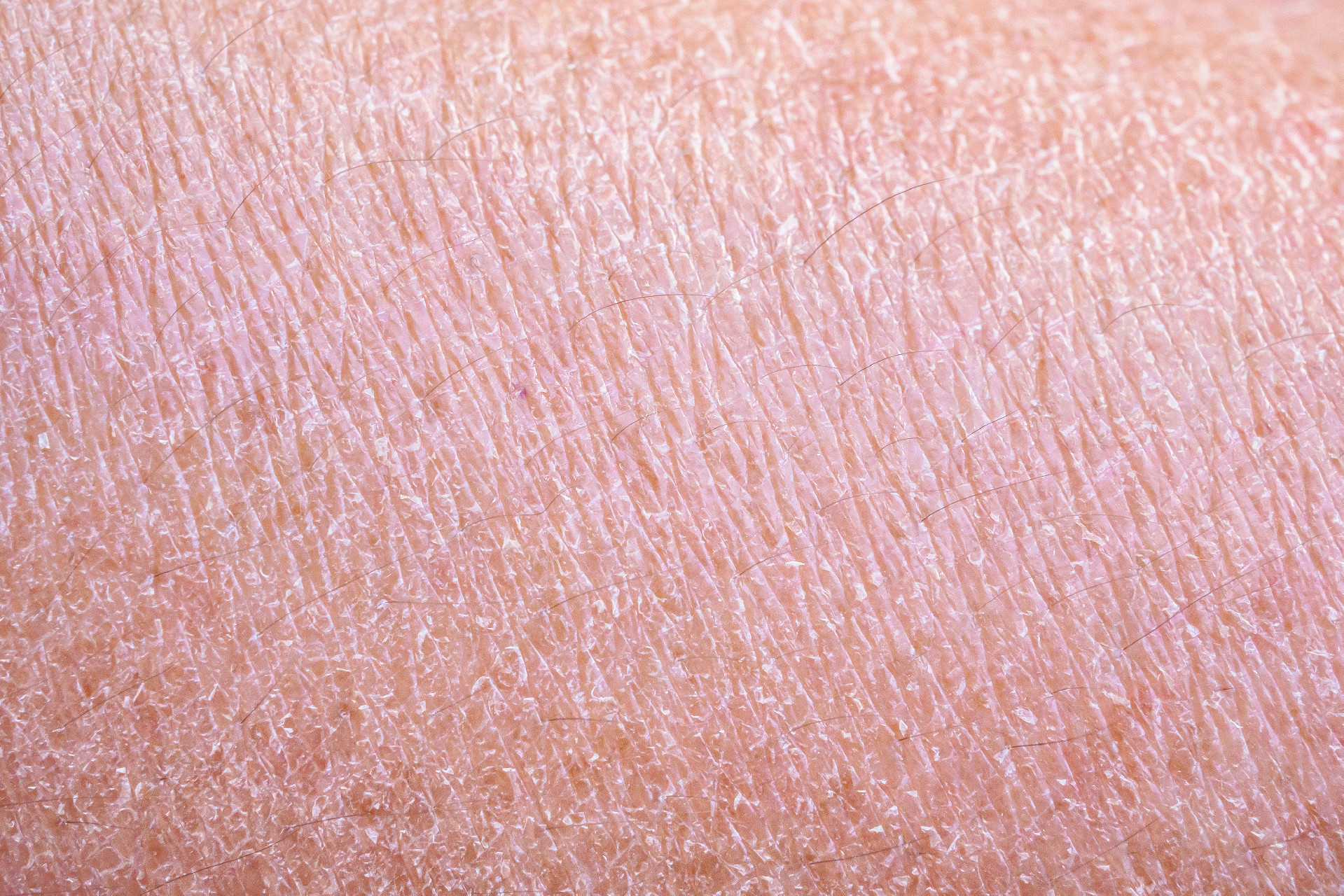 What Facial Good for Dry Skin in Singapore?